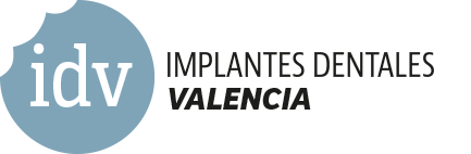implantes-dentales-valencia